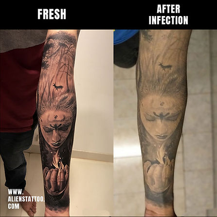 before after bad aftercare tattoo infection